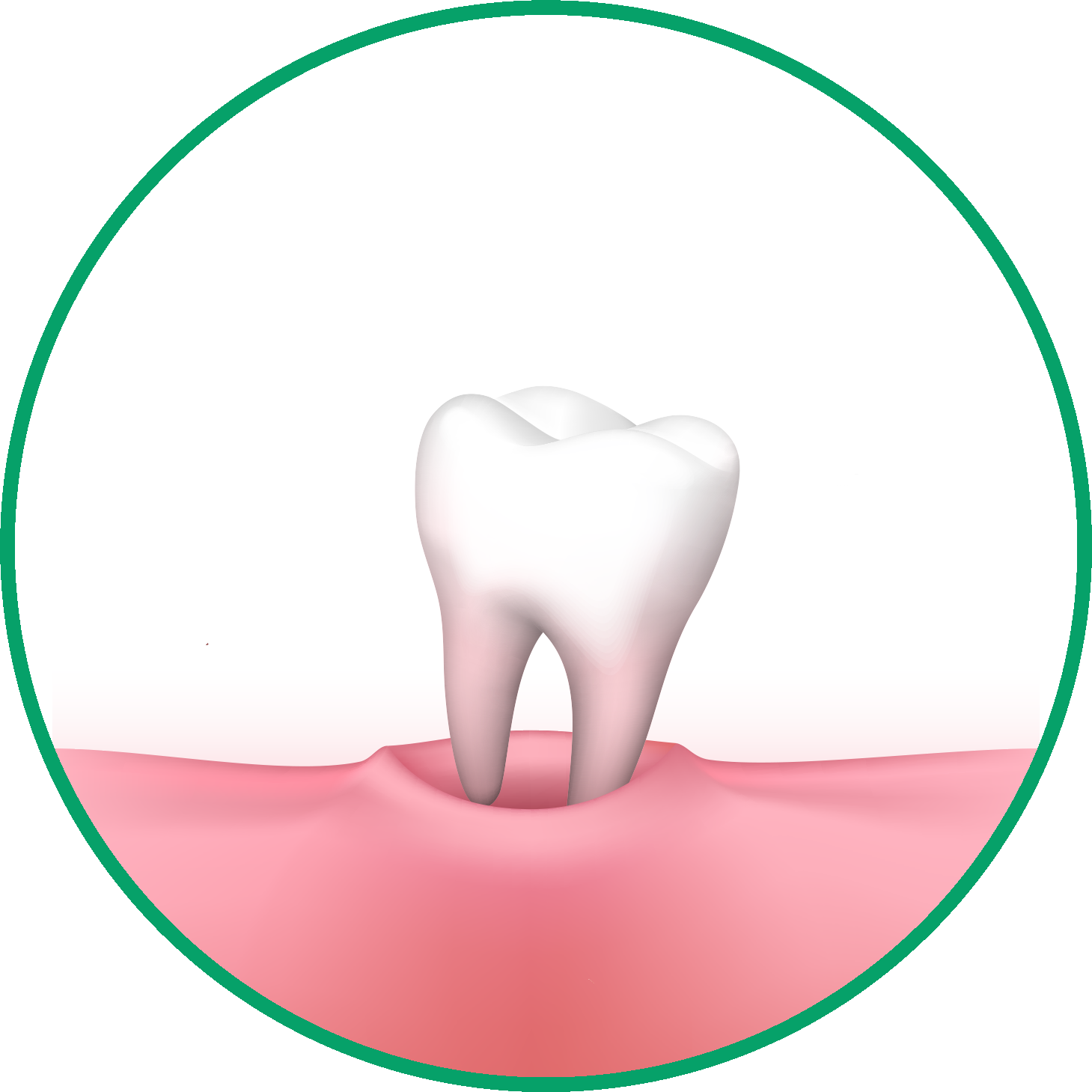 Milk Tooth Extraction - Dentiva